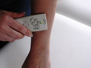 ALLERGY Testing and Treatment