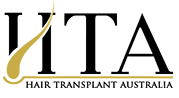 Hair Transplant Australia