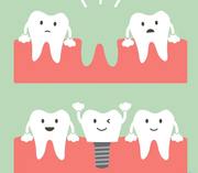 Tooth Implants Cost in Australia - My Gentle Dentist