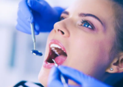 Fillings for Cavity - Tooth Cavity Filling 